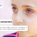 Cosa fare per la congiuntivite nei bambini