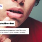 Cosa mettere per l'herpes nei bambini