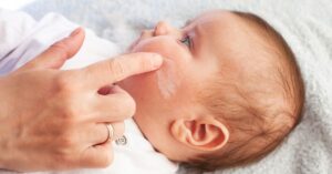 Crema per la dermatite nel bambino