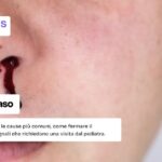 sangue naso, bambino che perde sangue dal naso