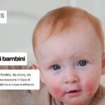 Sintomi dermatite nei bambini