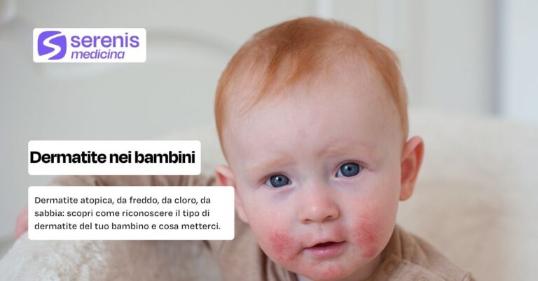 Sintomi dermatite nei bambini