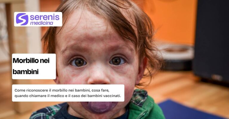 Macchie per il morbillo nei bambini