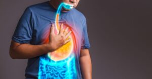 Pantorc per il reflusso gastroesofageo