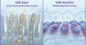 Villi sani e villi atrofici