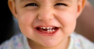 Denti da latte: quanti e quali sono