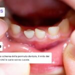 Denti da latte: quanti sono e quando cadono