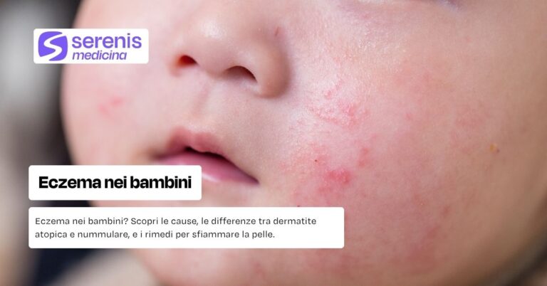 Eczema nei bambini: cause, sintomi e cura