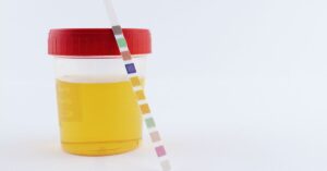 Colore dell'urina - esami delle urine