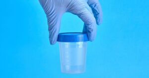 Barattolo sterile per esame delle urine.