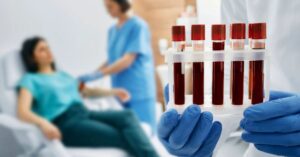 Esami del sangue per fibrinogeno alto in gravidanza