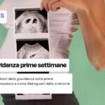 sintomi gravidanza prime settimane: scopri quali sono