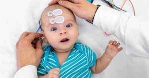 Screening trancutaneo nel neonato per misurare i valori di bilirubina.