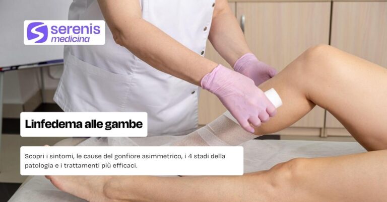 Linfedema alle gambe: cause, sintomi, stadi e cure