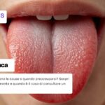 Lingua bianca: cause, sintomi e rimedi