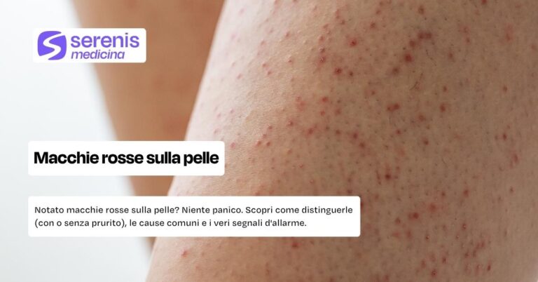 Cosa fare con le macchie rosse sulla pelle