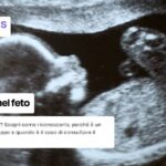 Singhiozzo del feto: scopri le cause e quando preoccuparsi
