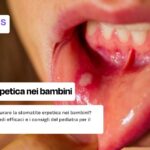 Stomatite erpetica nel bambino