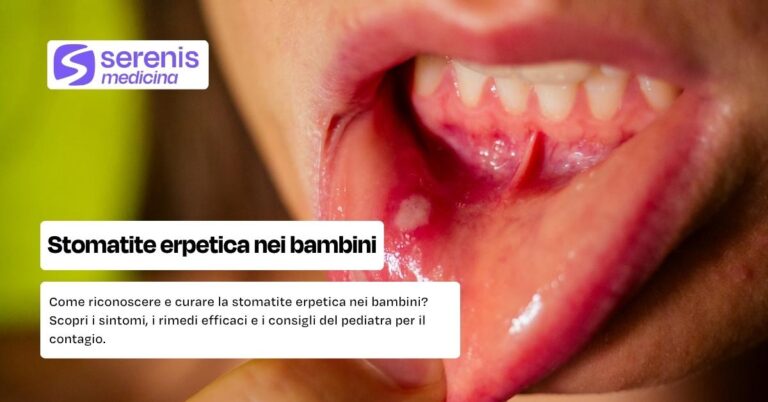 Stomatite erpetica nel bambino