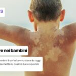 Eritema solare nei bambini