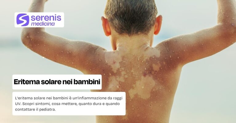 Eritema solare nei bambini