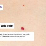 Puntini rossi sulla pelle
