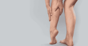 Si può camminare con un edema osseo?