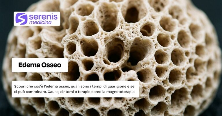 Edema osseo: cos'è, tempi di guarigione, terapie