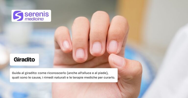 Giradito: come riconoscerlo e rimedi naturali