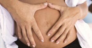 Il prolasso uterino può interessare anche altri organi