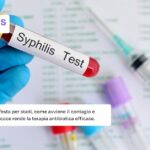 Sifilide: come si manifesta, come avviene il contagio e come diagnosticarla