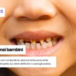 Denti marci nei bambini: cause, conseguenze e cure
