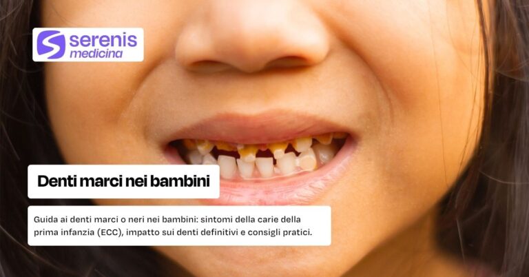 Denti marci nei bambini: cause, conseguenze e cure