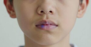 Labbra viola nei bambini: cosa significa e perchè accade