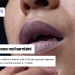Labbra viola nei bambini: cause, rimedi
