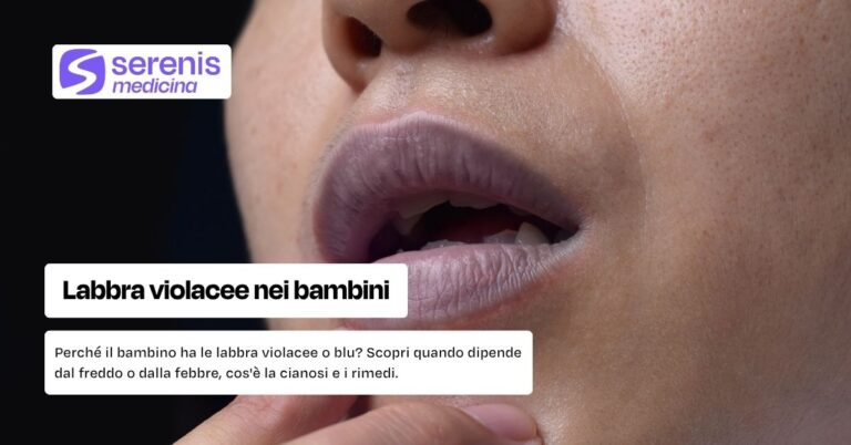 Labbra viola nei bambini: cause, rimedi