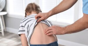 Test di Adams per la scoliosi nei bambini