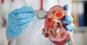 Chi è e cosa fa l'urologo pediatrico