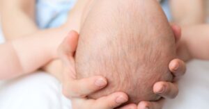 Quali sono i punti pericolosi della testa del neonato?