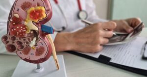 Cosa vede l'urologo con l'ecografia reno-vescicale e come si esegue