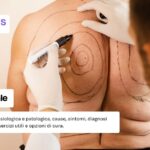 Cifosi dorsale: cos'è, sintomi ed esercizi