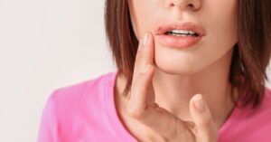 Differenza tra herpes labiale e herpes vaginale