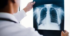 Diagnosi specialistica per cifosi dorsale