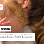Crosta lattea neonato