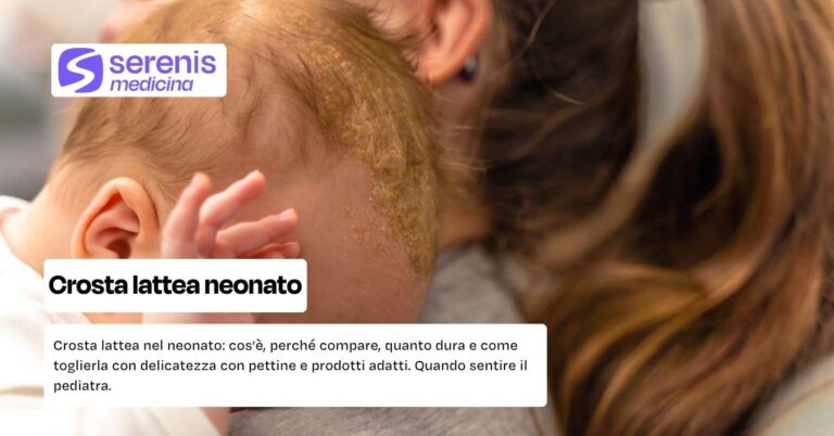 Crosta lattea neonato