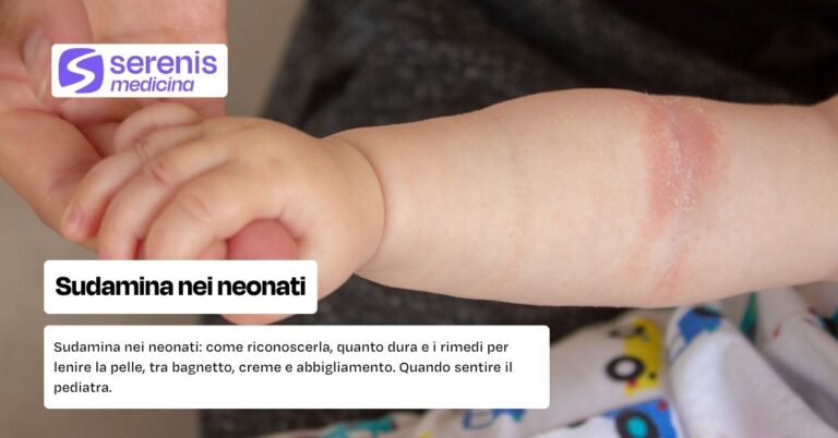 Sudamina nei neonati
